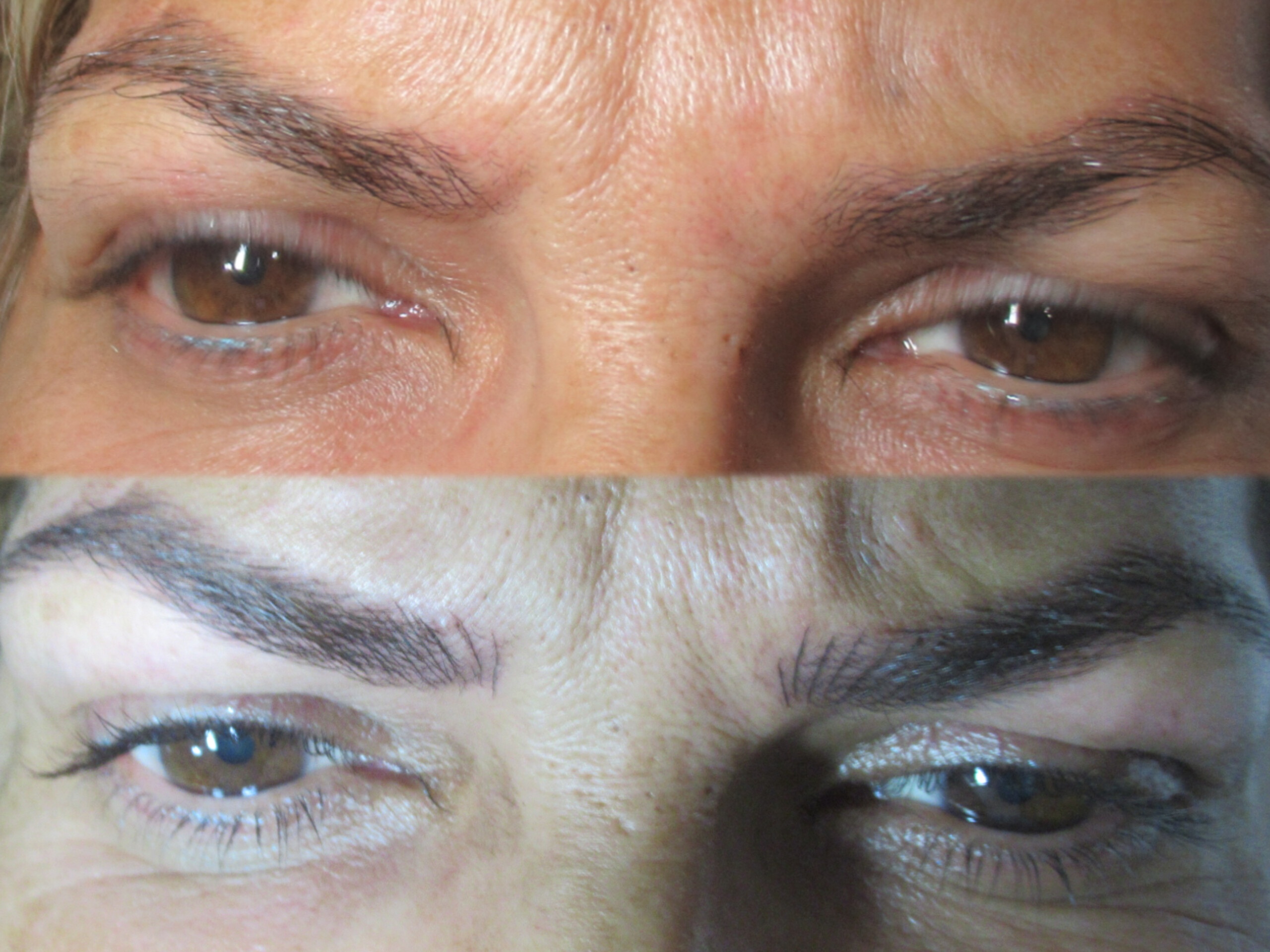 מיקרובליידינג - עבודה 11