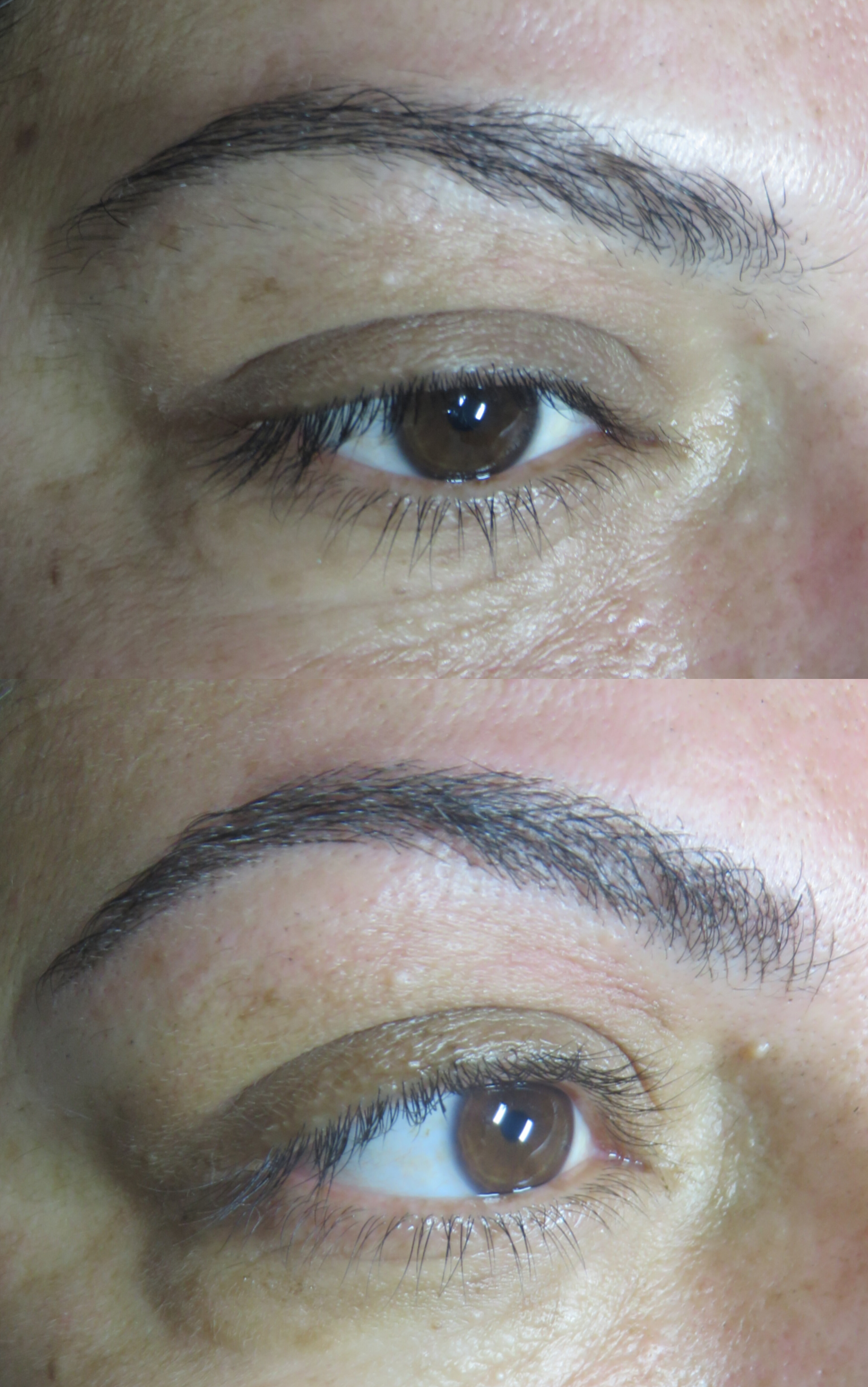 מיקרובליידינג - עבודה 12