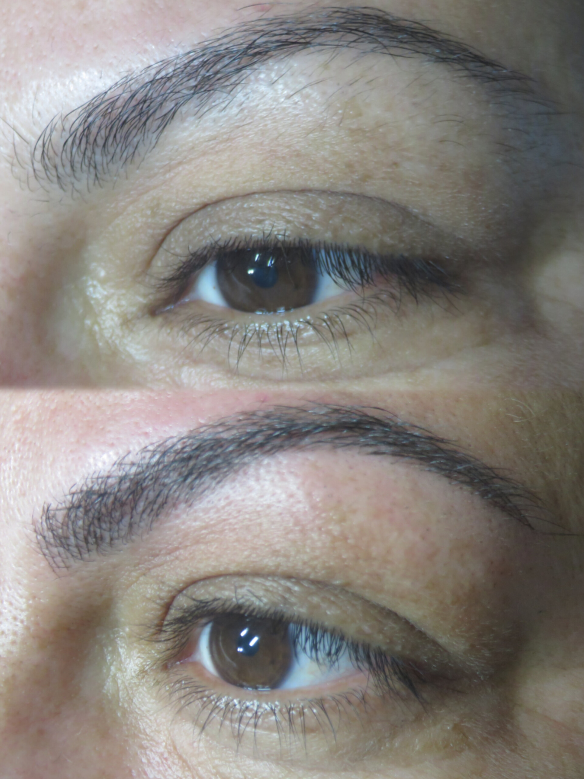 מיקרובליידינג - עבודה 14