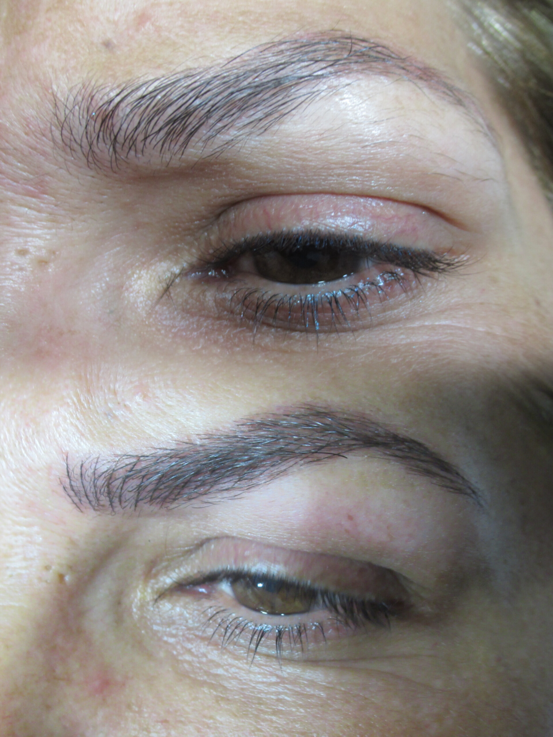 מיקרובליידינג - עבודה 15