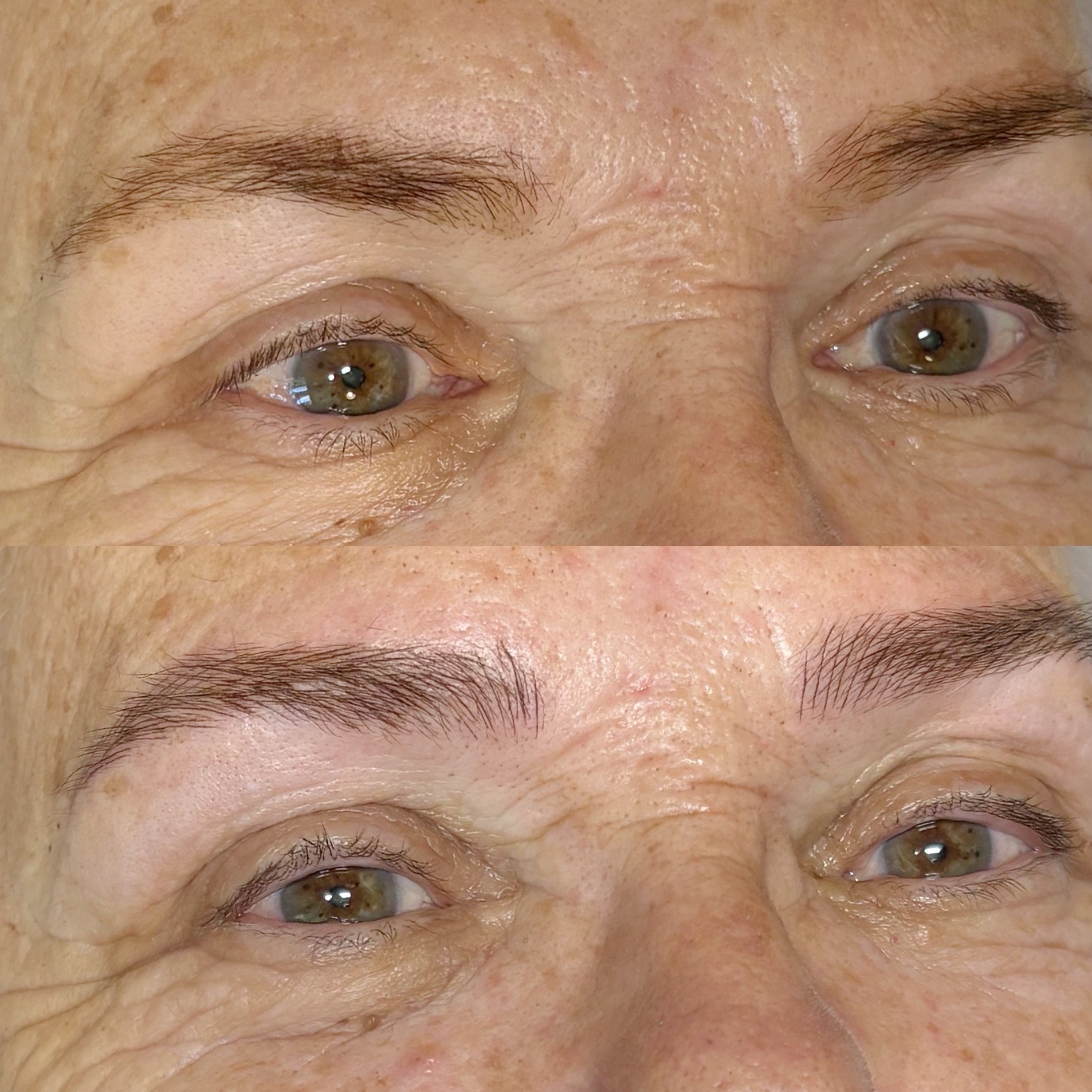 מיקרובליידינג - עבודה 16