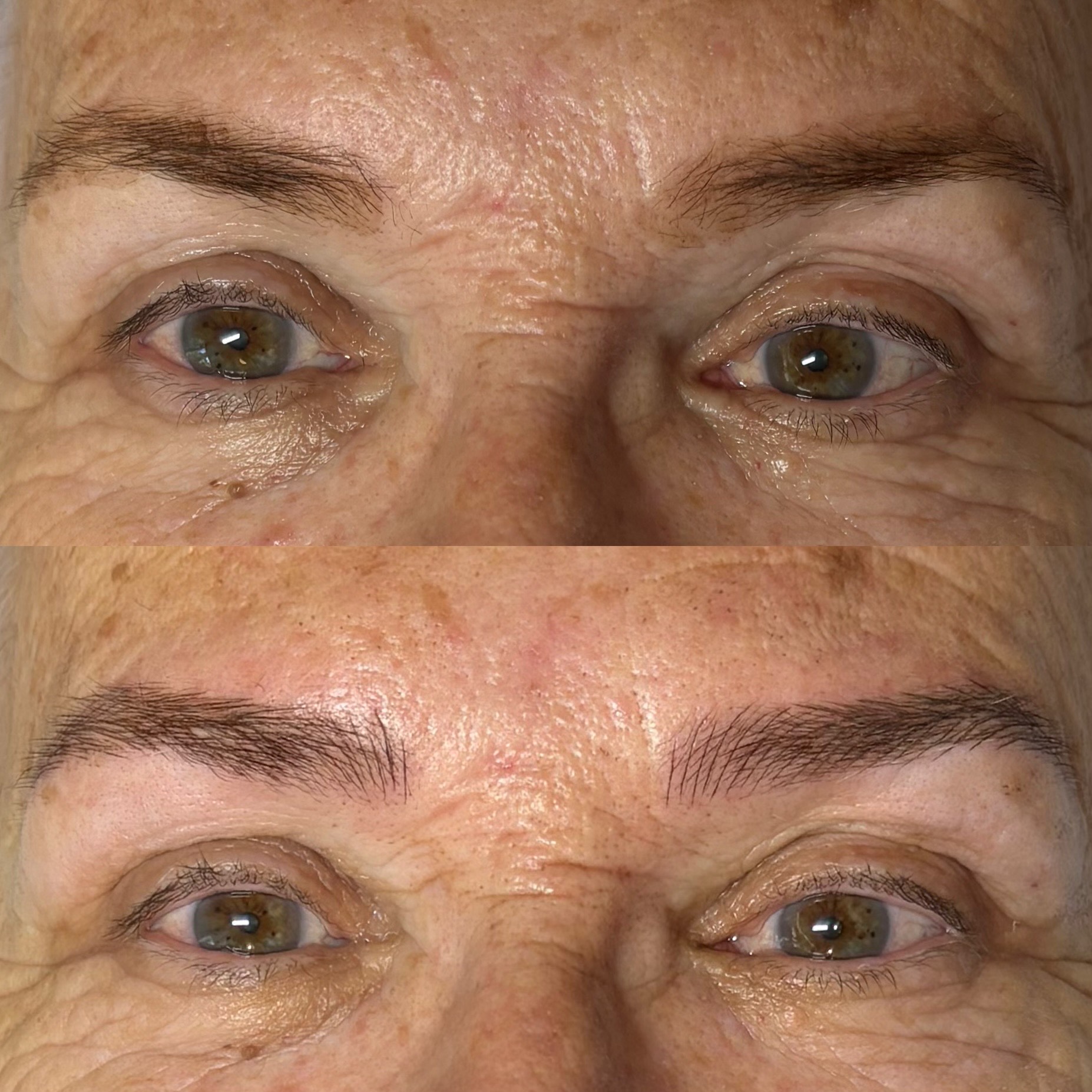 מיקרובליידינג - עבודה 17