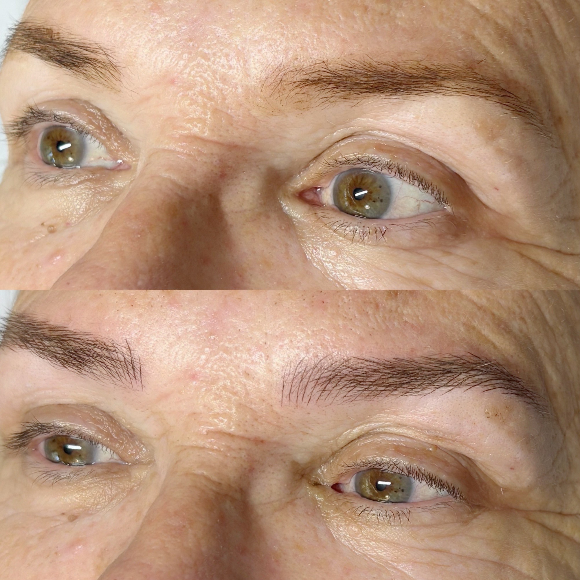 מיקרובליידינג - עבודה 18