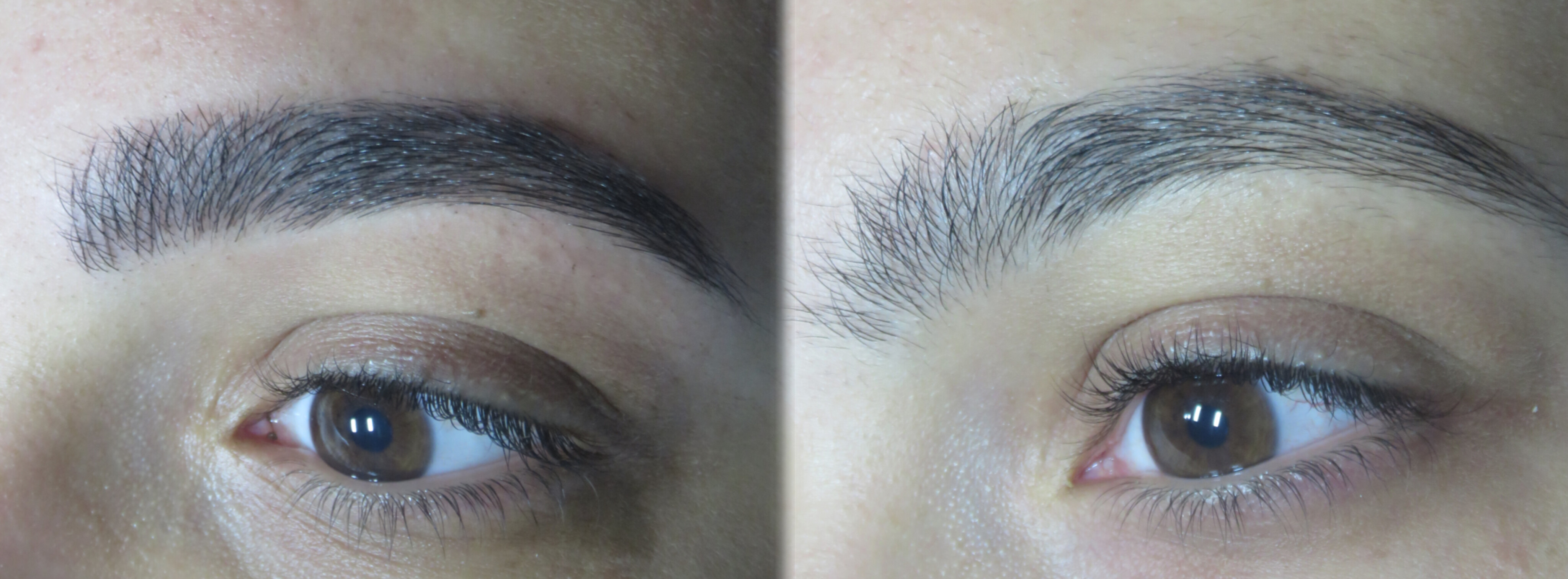 מיקרובליידינג - עבודה 8